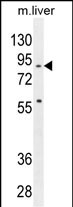 WB - SPIRE2 Antibody (Center) AP10600c
