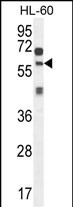 ZSWIM1 Antibody (C-term) (Cat. #AP10601b) western blot analysis in HL-60 cell line lysates (35ug/lane).This demonstrates the ZSWIM1 antibody detected the ZSWIM1 protein (arrow).