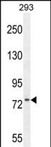WB - ZNF611 Antibody (N-term) AP10604a