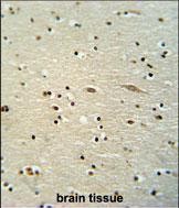 IHC-P - MAMSTR Antibody (N-term) AP10611A