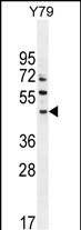 LACE1 Antibody (N-term) (Cat. #AP10615a) western blot analysis in Y79 cell line lysates (35ug/lane).This demonstrates the LACE1 antibody detected the LACE1 protein (arrow).