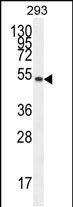 WB - IGSF5 Antibody (N-term) AP10623a
