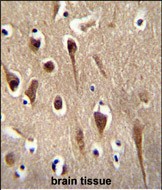 IHC-P - FBXO39 Antibody (C-term) AP10627b