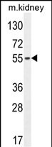 WB - FBXO39 Antibody (C-term) AP10627b