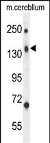 WB - CD109 Antibody (N-term) AP10639a