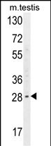 WB - YDJC Antibody (Center) AP10640c