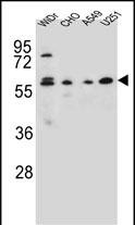 CEP70 Antibody (Center) (Cat. #AP10646c) western blot analysis in WiDr,CHO,A549,U251 cell line lysates (35ug/lane).This demonstrates the CEP70 antibody detected the CEP70 protein (arrow).