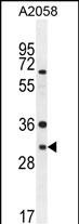 WB - ARV1 Antibody  (N-term) AP10655a