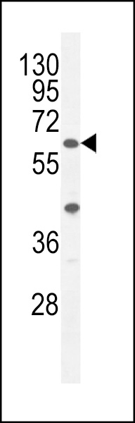 ACF Antibody (C-term) (Cat. #AP10670b) western blot analysis in A375 cell line lysates (35ug/lane).This demonstrates the ACF antibody detected the ACF protein (arrow).