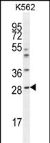 APCS Antibody (C-term) (Cat. #AP10677b) western blot analysis in K562 cell line lysates (35ug/lane).This demonstrates the APCS antibody detected the APCS protein (arrow).