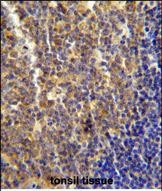 IHC-P - LYRM4 Antibody (Center) AP10681C