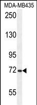 ARHGAP10 Antibody (Center) (Cat. #AP10695b) western blot analysis in MDA-MB435 cell line lysates (35ug/lane).This demonstrates the ARHGAP10  antibody detected the ARHGAP10  protein (arrow).