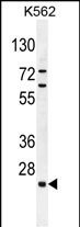 WB - CDIN1 Antibody (Center) AP10700c