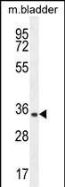 WB - CDIN1 Antibody (Center) AP10700c