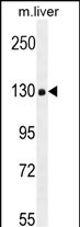 COL18A1 Antibody (Center) (Cat. #AP10706c) western blot analysis in mouse liver tissue lysates (35ug/lane).This demonstrates the COL18A1 antibody detected the COL18A1 protein (arrow).