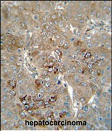 IHC-P - CES4 Antibody (N-term) AP10710a