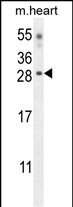 CLDN6 Antibody (Center) (Cat. #AP10712c) western blot analysis in mouse heart tissue lysates (35ug/lane).This demonstrates the CLDN6 antibody detected the CLDN6 protein (arrow).