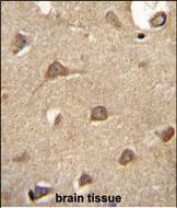 IHC-P - ENTPD3 Antibody (C-term) AP10716b