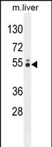 WB - GLCCI1 Antibody (N-term) AP10720A