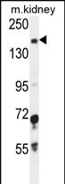WB - IGSF1 Antibody (C-term) AP10732b