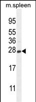 CRYGS Antibody (C-term) (Cat. #AP10737b) western blot analysis in mouse spleen tissue lysates (35ug/lane).This demonstrates the CRYGS antibody detected the CRYGS protein (arrow).