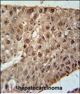 IHC-P - ZC4H2 Antibody (C-term) AP10760b