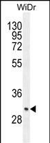 WB - ZC4H2 Antibody (C-term) AP10760b