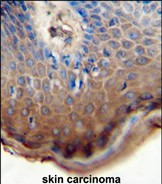 IHC-P - TJAP1 Antibody (N-term) AP10762a
