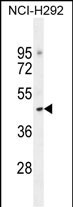 WB - TJAP1 Antibody (N-term) AP10762a