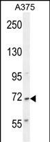 WB - AL2SA Antibody (N-term) AP10777a