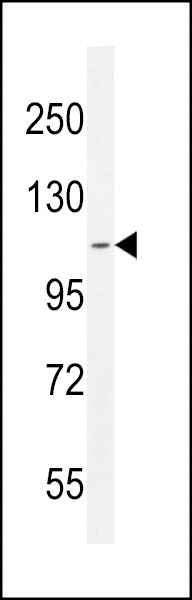 WB - AT8B2 Antibody (N-term) AP10779a