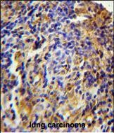 IHC-P - CK073 Antibody (N-term) AP10780a