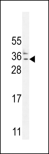 CK073 Antibody  (N-term) (Cat. #AP10780a) western blot analysis in MDA-MB435 cell line lysates (35ug/lane).This demonstrates the CK073 antibody detected the CK073 protein (arrow).