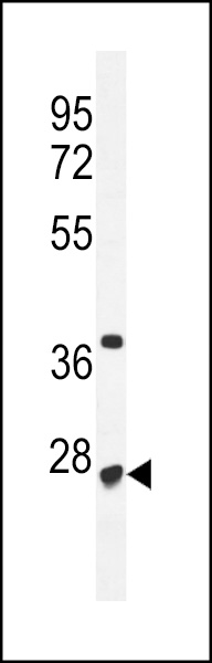 WB - CF153 Antibody (C-term) AP10785b