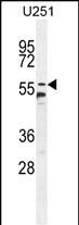 WB - CCDC9 Antibody (N-term) AP10786A