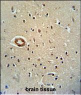 IHC-P - CWC22 Antibody (N-term) AP10788a