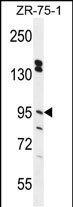 WB - ERMP1 Antibody (C-term) AP10790b