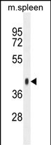 WB - SYTL3 Antibody  (N-term) AP10804a