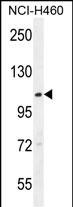 WB - ACD10 Antibody  (Center) AP10806c