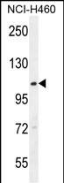 ACD10 Antibody  (Center) (Cat. #AP10806c) western blot analysis in NCI-H460 cell line lysates (35ug/lane).This demonstrates the ACD10 antibody detected the ACD10 protein (arrow).
