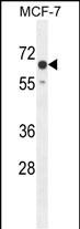 WB - CO027 Antibody  (C-term) AP10811b