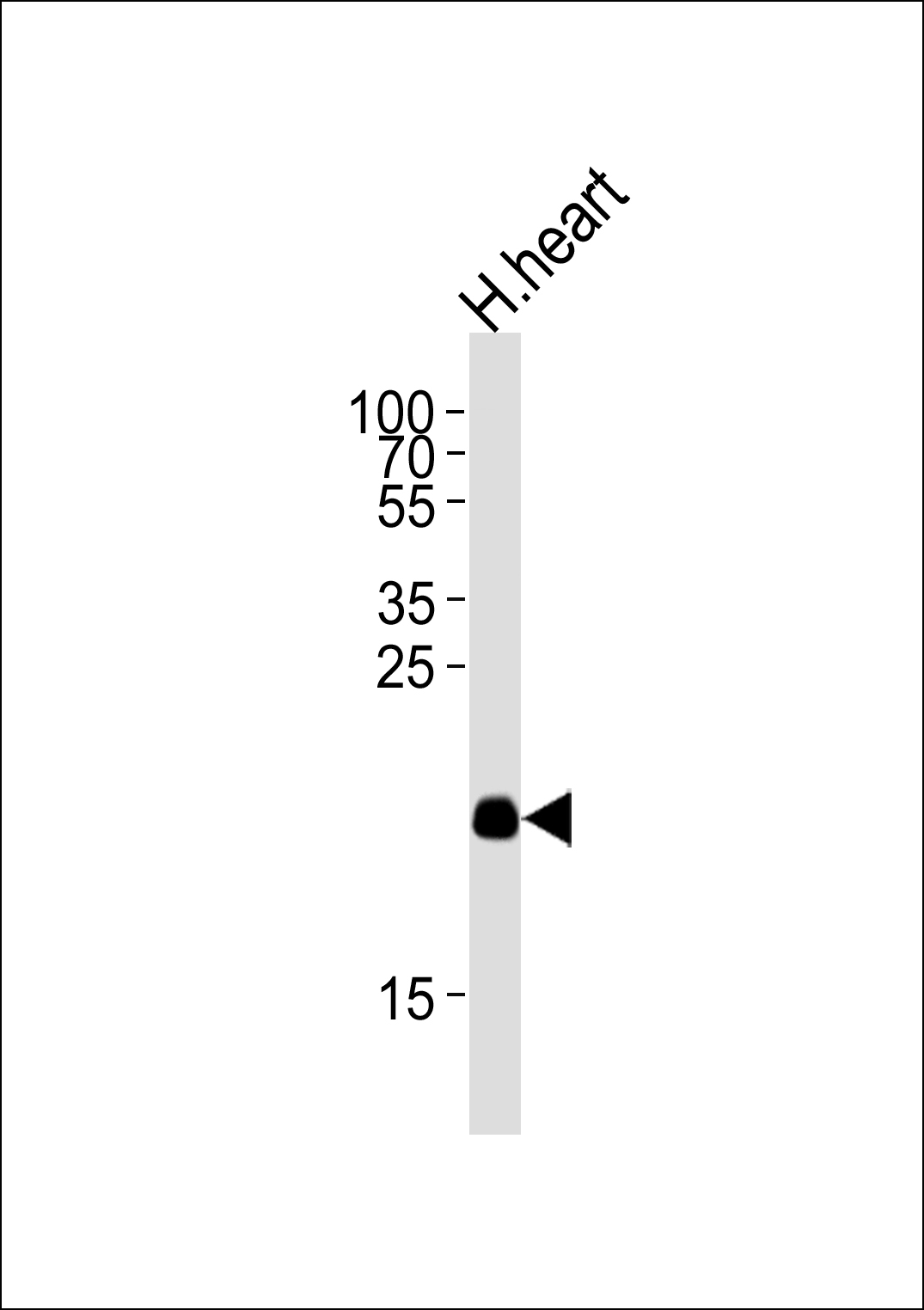 WB - ORML2 Antibody  (Center) AP10815c