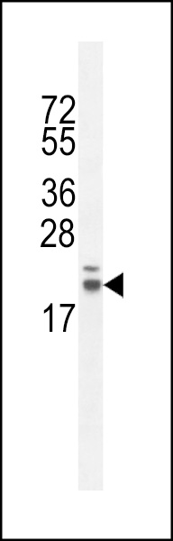 RN185 Antibody  (Center) (Cat. #AP10818c) western blot analysis in CHO cell line lysates (35ug/lane).This demonstrates the RN185 antibody detected the RN185 protein (arrow).