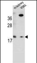 WB - RN185 Antibody  (Center) AP10818c