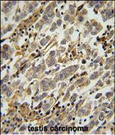 IHC-P - ASB17 Antibody (C-term) AP10825b