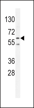 WB - PRKAA2 (Thr172) Antibody  (Center) AP10846a