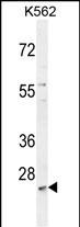 WB - MCART2 Antibody (N-term) AP10890a