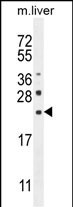 WB - CLEC2L Antibody (N-term) AP10911a