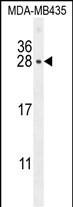 CSH1 Antibody (C-term) (Cat. #AP10929b) western blot analysis in MDA-MB435 cell line lysates (35ug/lane).This demonstrates the CSH1 antibody detected the CSH1 protein (arrow).