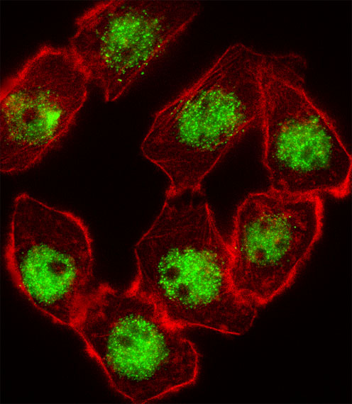 Fluorescent image of A549 cell stained with CDKN1C Antibody (N-term)(Cat#AP10945a).A549 cells were fixed with 4% PFA (20 min), permeabilized with Triton X-100 (0.1%, 10 min), then incubated with CDKN1C primary antibody (1:25, 1 h at 37?). For secondary antibody, Alexa Fluor� 488 conjugated donkey anti-rabbit antibody (green) was used (1:400, 50 min at 37?).Cytoplasmic actin was counterstained with Alexa Fluor� 555 (red) conjugated Phalloidin (7units/ml, 1 h at 37?).CDKN1C immunoreactivity is localized to Nucleus significantly.